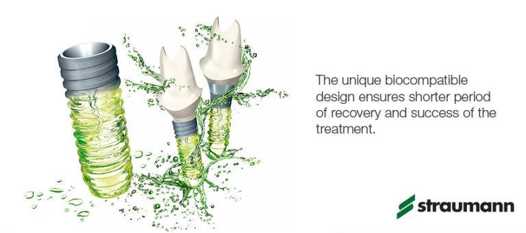 implants